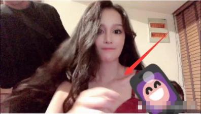 赵本山女儿球球减肥50斤变网红脸 发文暗示已整容
