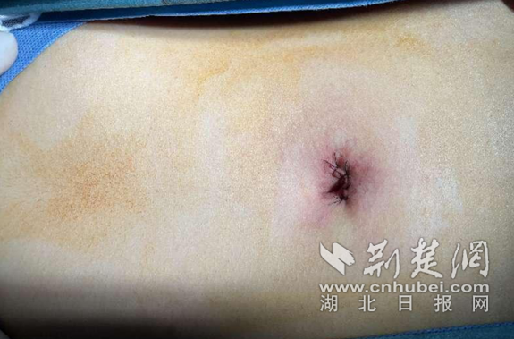微信截图_20220318112751_副本.png.png