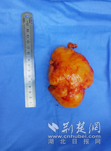 微信截图_20220303144814_副本.png.png