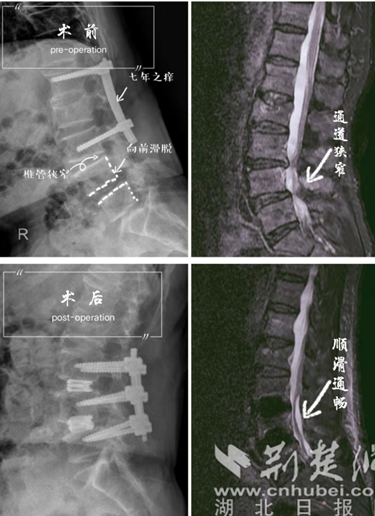 微信截图_20220316093936_副本.png.png