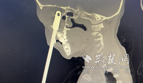 微信截图_20220408154840_副本.png.png