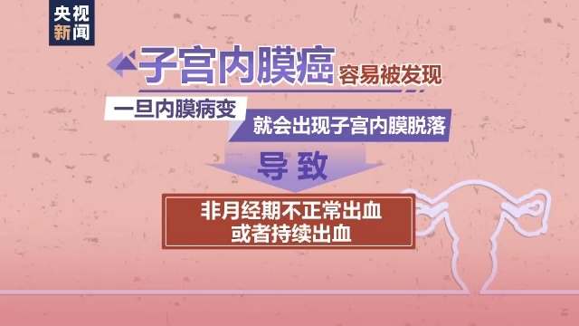 全国肿瘤防治宣传周今天启动 三大妇科恶性肿瘤每年新发病例超20万欧宝平台(图1)