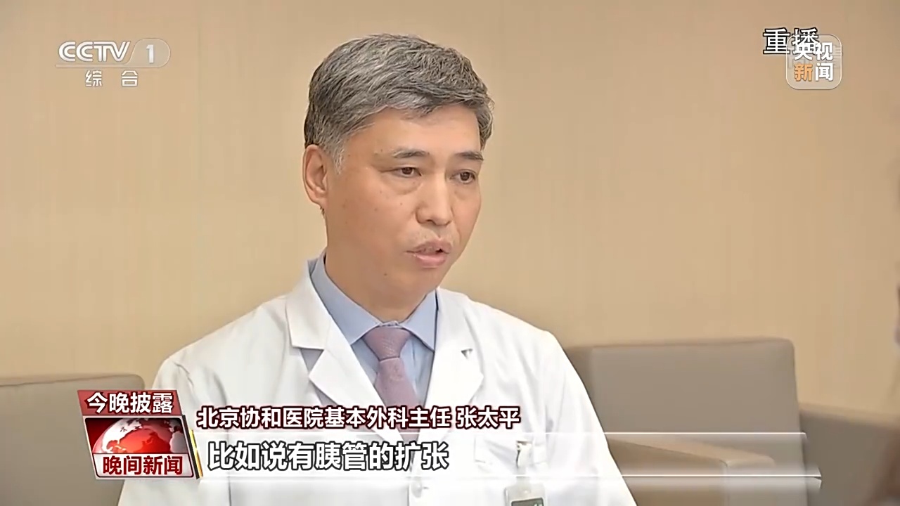 北京协和医院基本外科主任 张太平:比如说有胰管的扩张,胆管的扩张