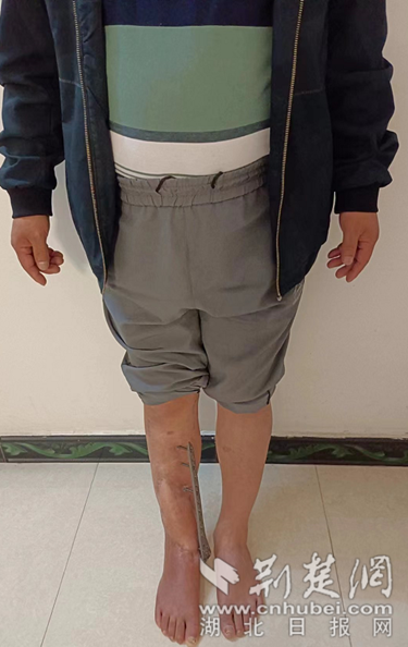 微信截图_20221208171049_副本.png.png