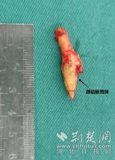 微信截图_20230404211518_副本.png.png