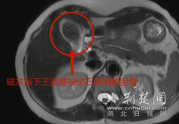 微信截图_20230707144209_副本.png.png