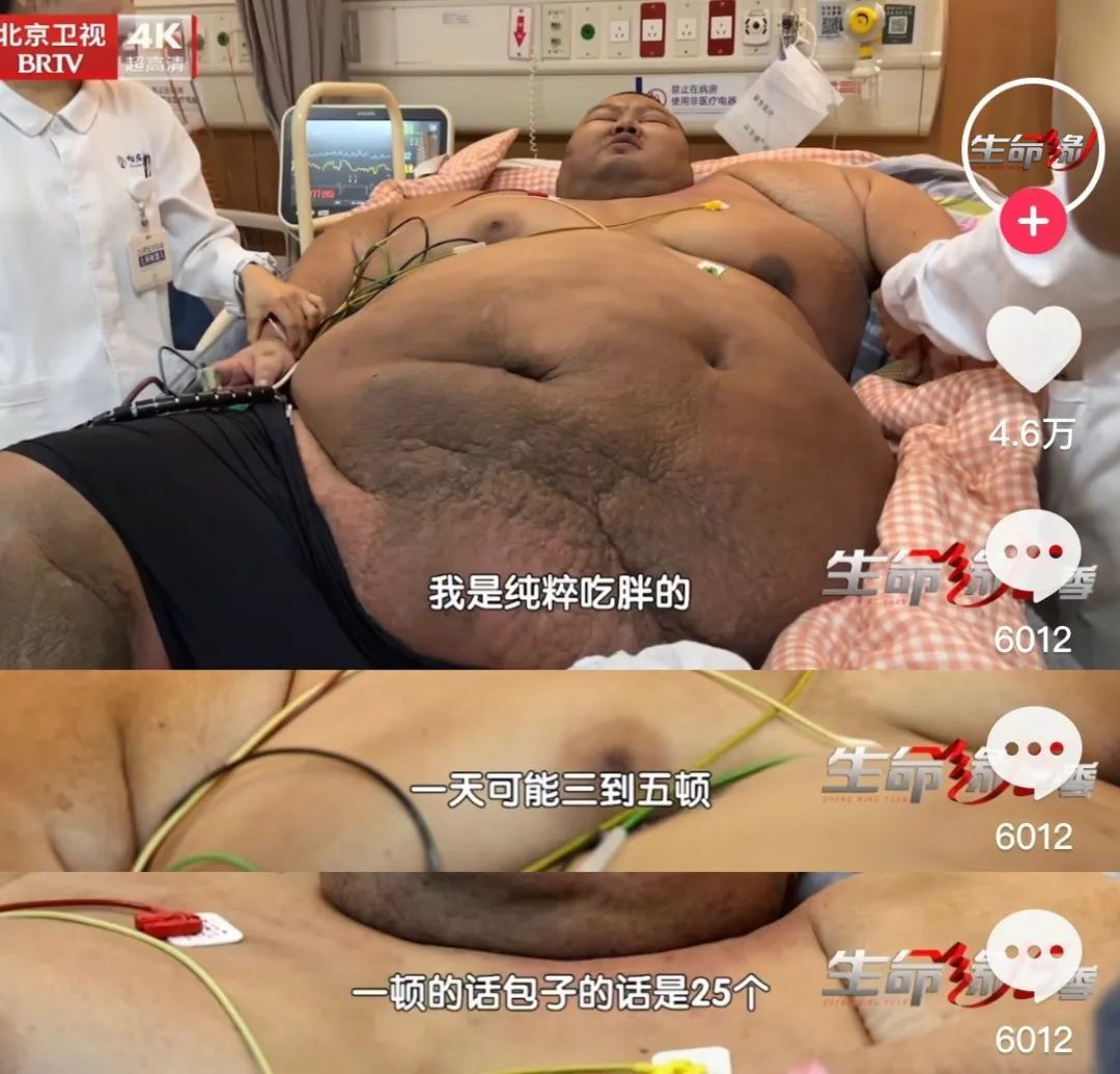 曾一顿吃25MK体育个包子、躺货车进京就医的他减重300多斤！(图3)