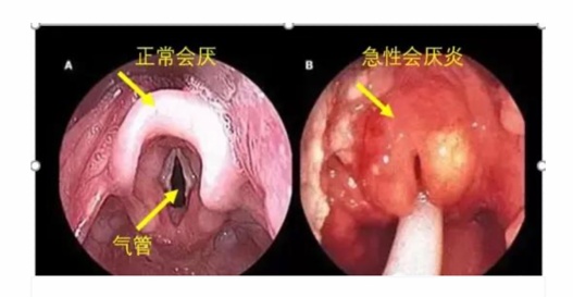 有些患者距离访问死亡只有10分钟的时间！不要以