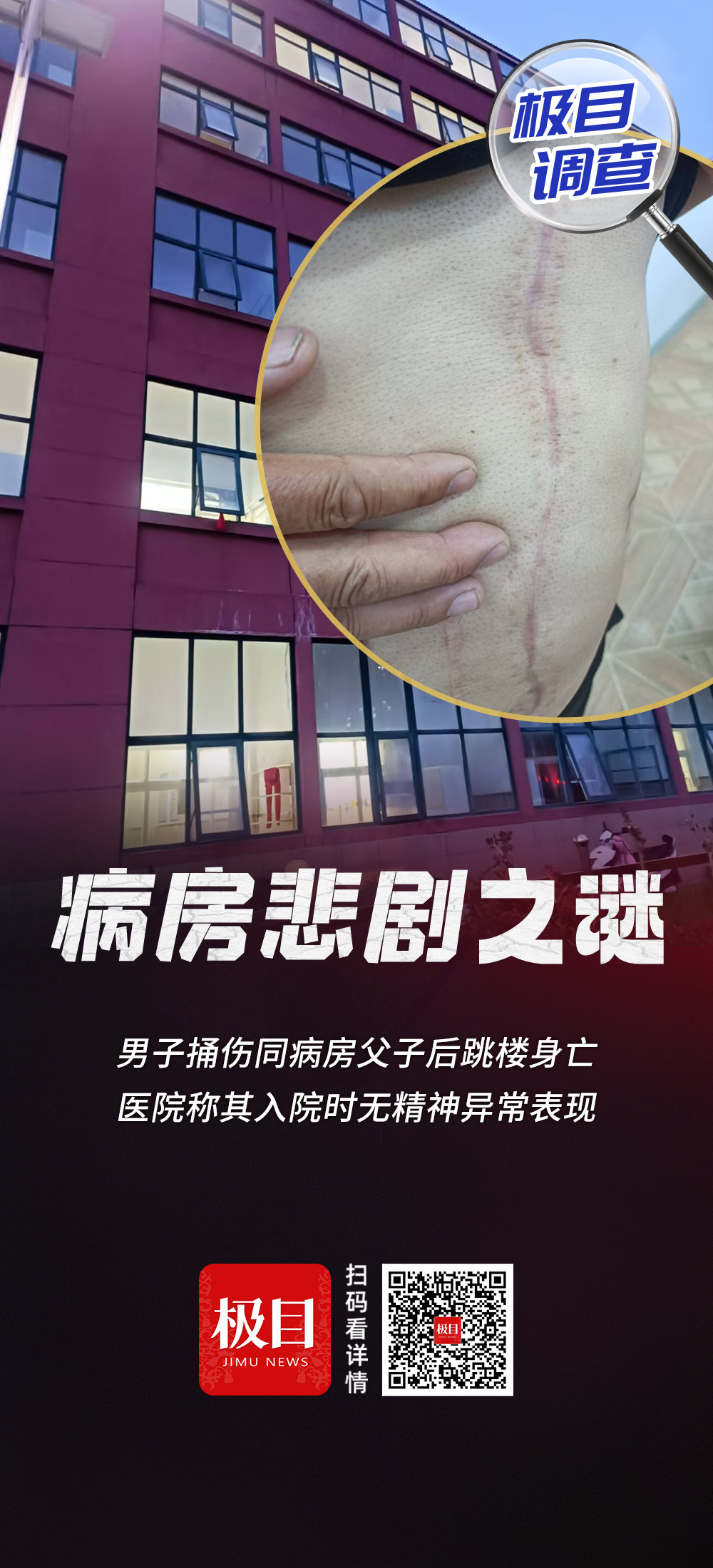 病房悲剧的奥秘：当晚，他住院并从建筑物跳下