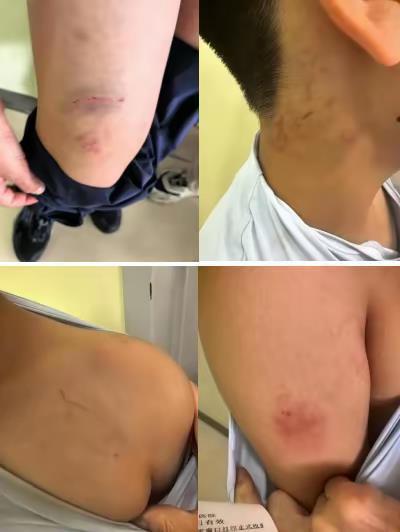 10岁男孩疑遭训练组织教师扇耳光，天津当地：已建立处置专班