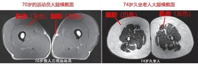 运动是加快变老，仍是推迟变老？本相揭开！