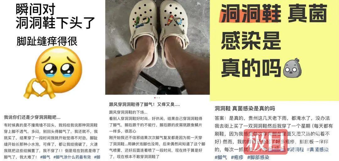 洞洞鞋竟是“真菌培养皿”？专家表明：夏天热销鞋隐藏健康危险