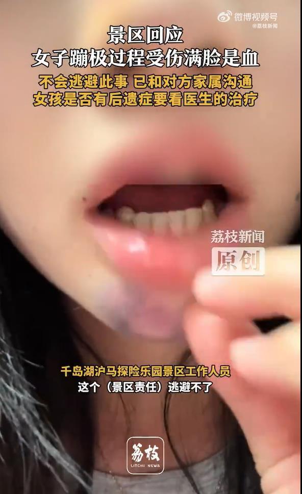 极目锐评丨女子景区玩蹦极被磕成脑震荡，说好的安全榜首呢？