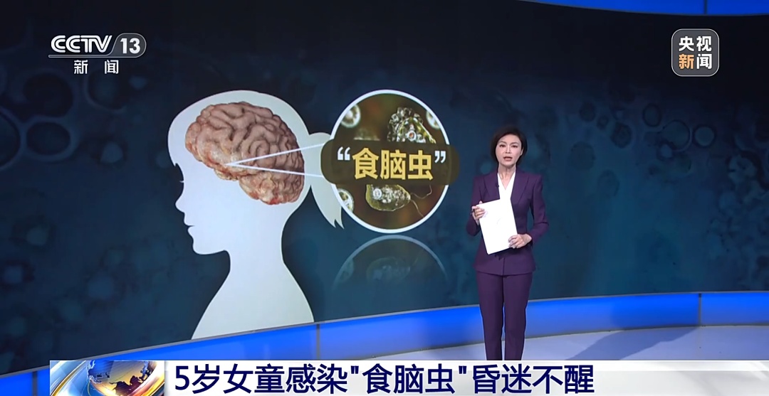 儿童玩水后感染“食脑虫”不省人事 医师重要提示→