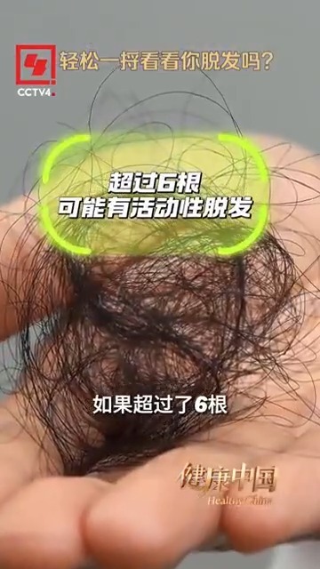健康的中国丨你丢了头发了吗？让我们尝试发胶