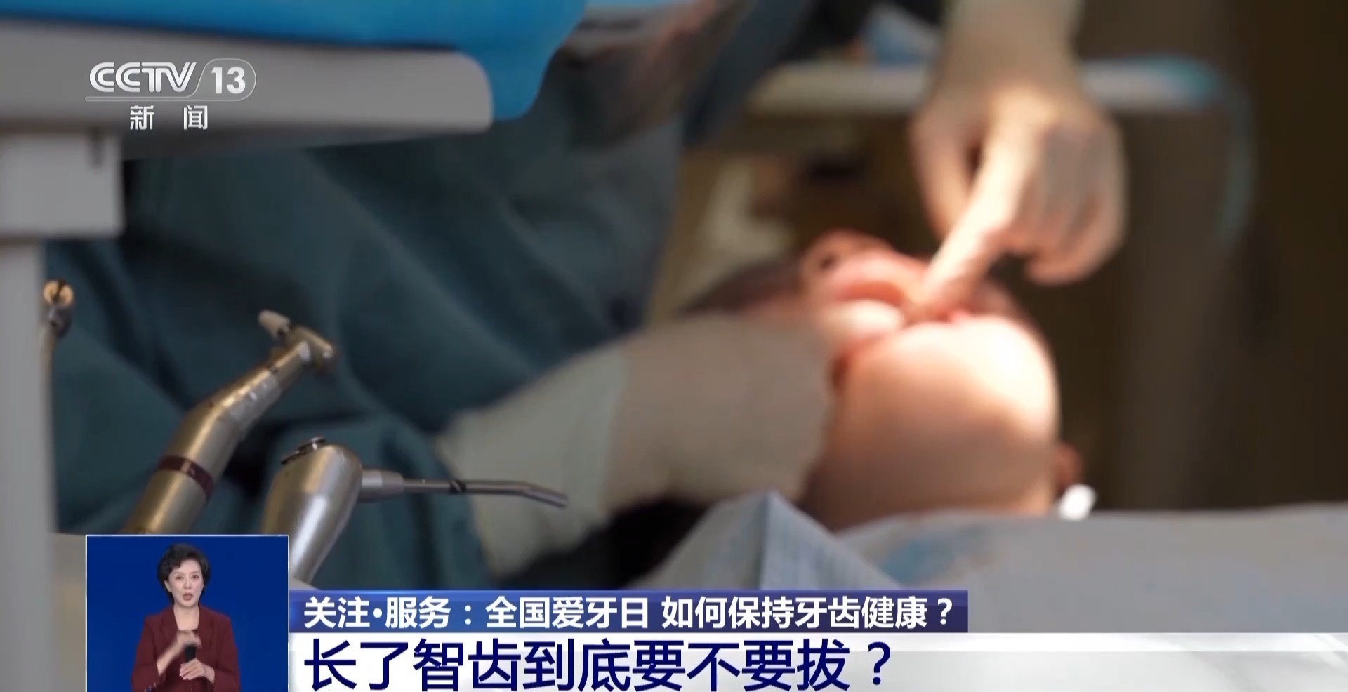 应该去除智慧牙齿吗？如何避免“旧齿”？这些