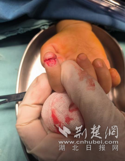 门“咬住了我的手”，差点把我的手指切掉！