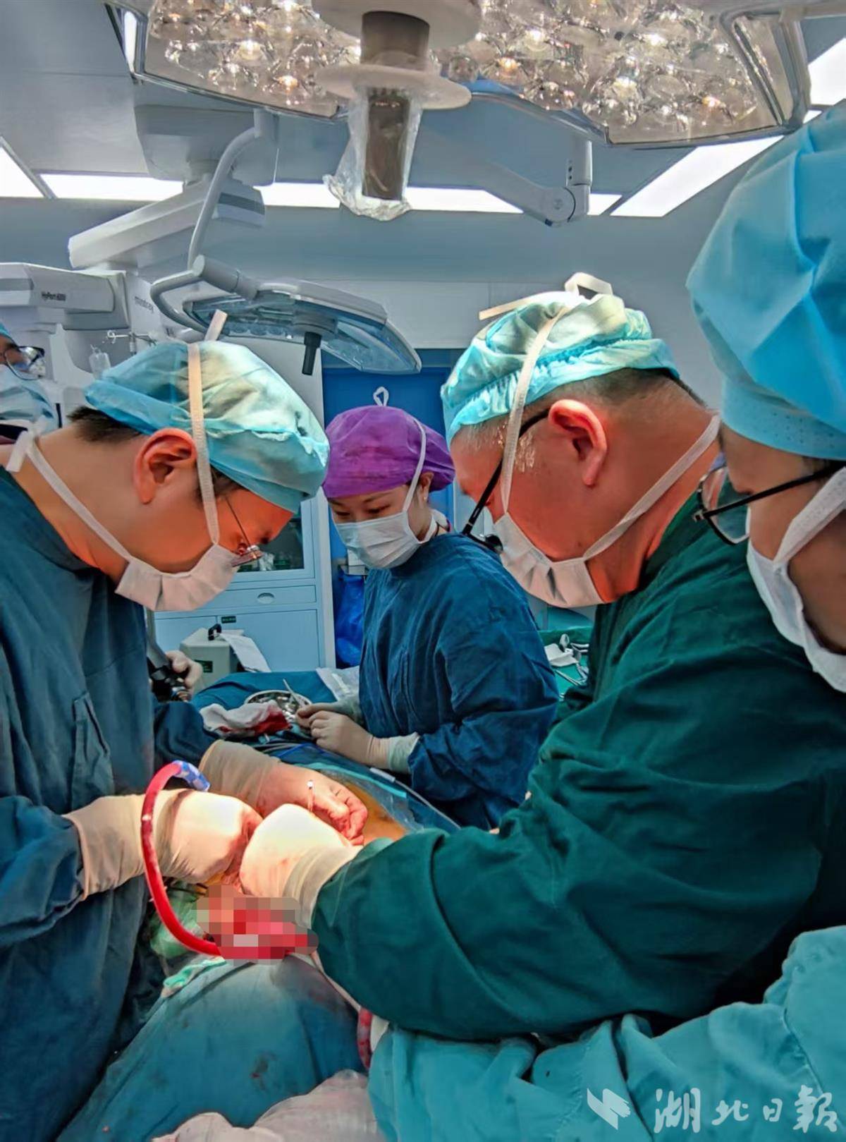 专家打造“皮肤”再造生命新气道 武汉同济医院