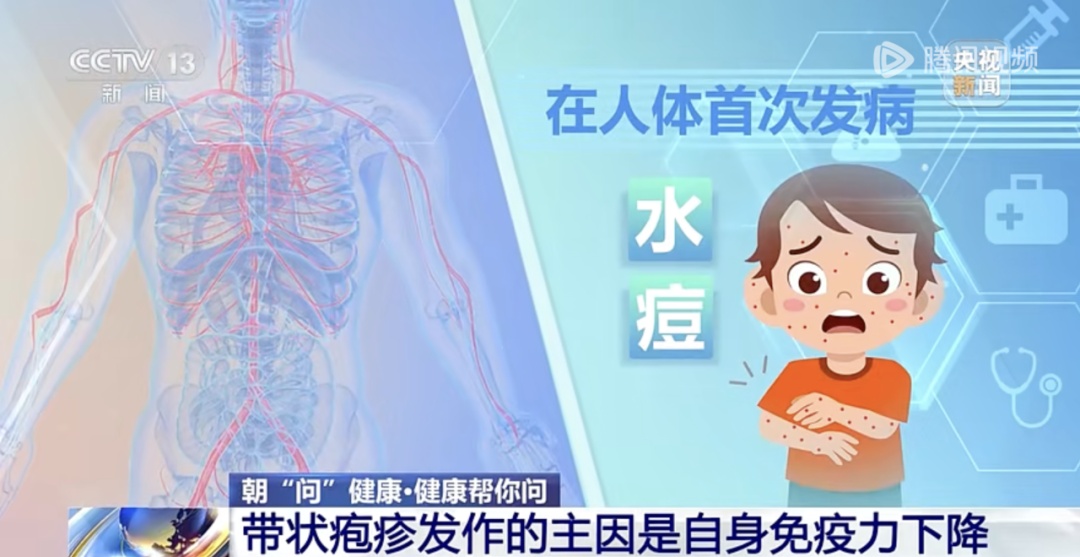 拆完快递没洗手,当心“惹”上眼部带状疱疹