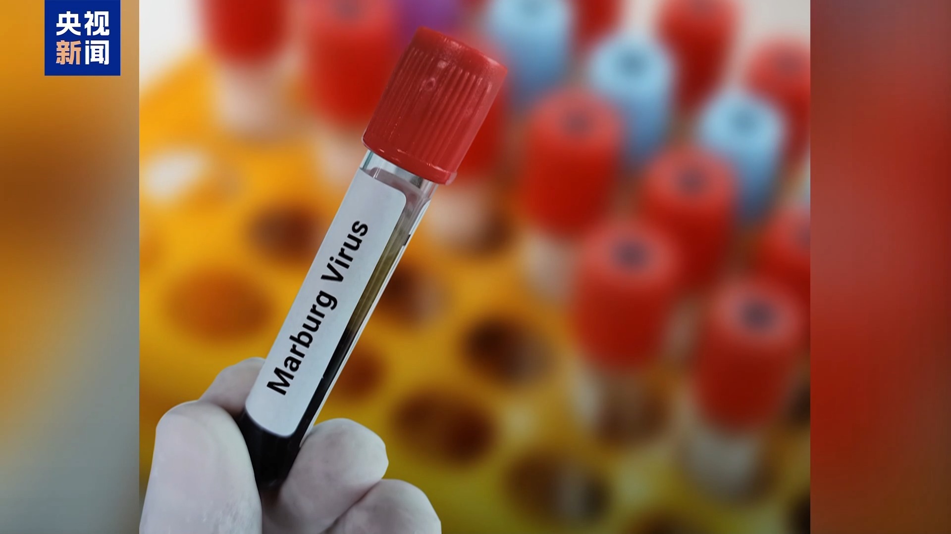 非洲疾控中心采取措施防止马尔堡病毒跨境传播