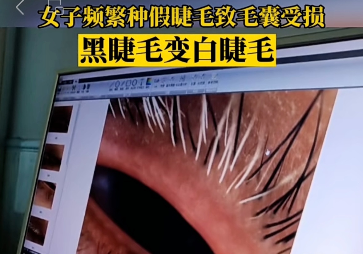 一种巨伤眼的行为，很多女生最近都在做！（不是戴美瞳）
