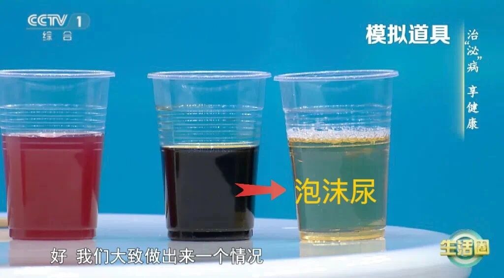  喝水后4个异常 可能是肾发出的“求救信号”