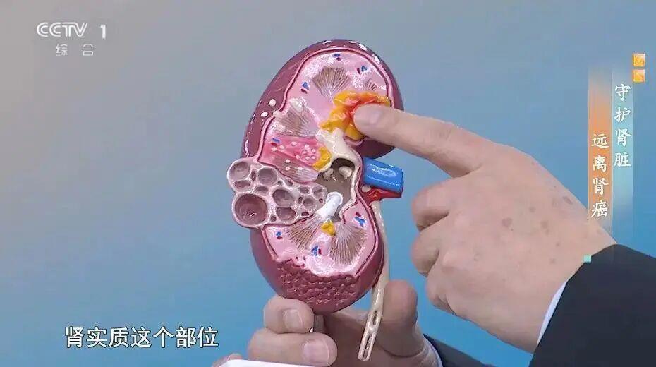  视频丨喝水后出现这5种情况 可能是身体在“求救”