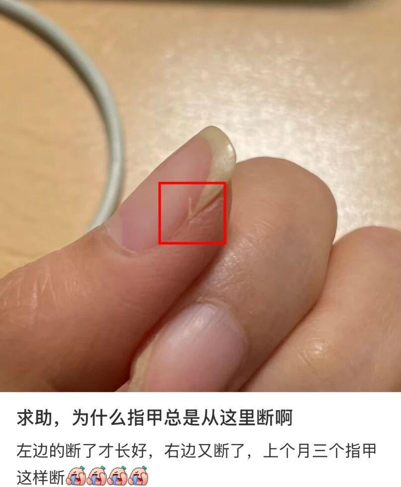 指甲为什么总从这里断开？是缺钙吗？这些身体信号要注意