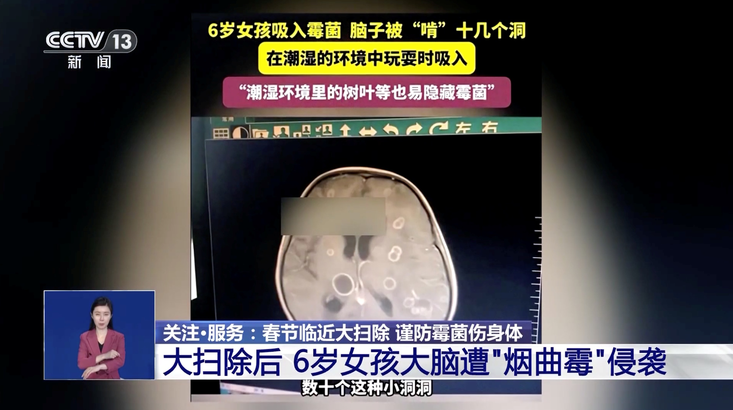 大扫除后女孩脑部感染 这些健康隐患要避开