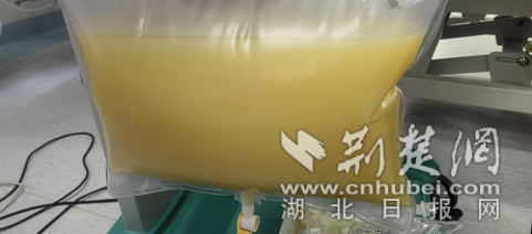 血脂超标47倍！大学生寒假暴饮暴食吃出“牛奶血”