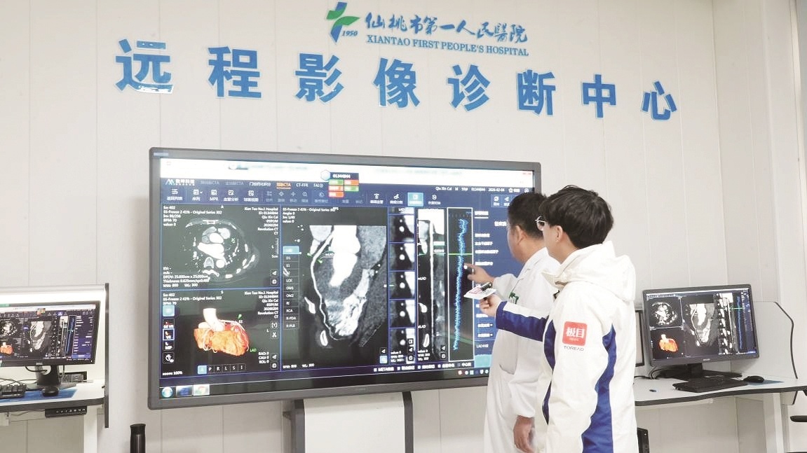 县域医共体持续推进 群众在家门口享三甲医院诊疗