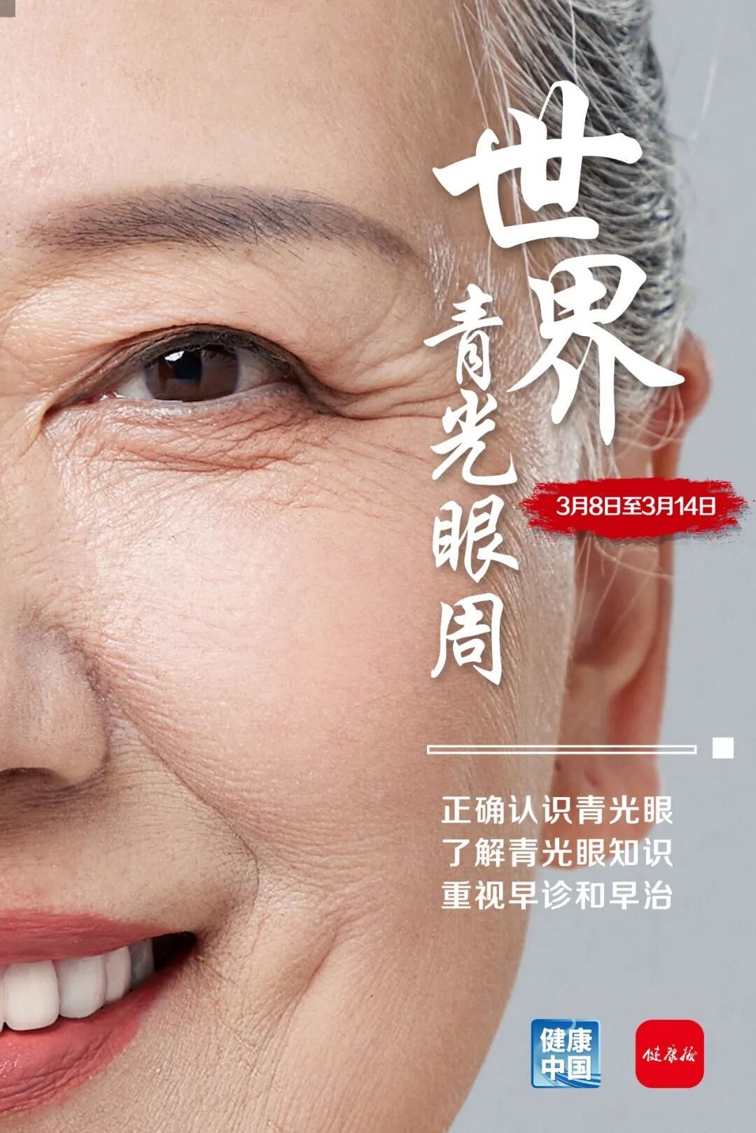 关于青光眼，这些误区要警惕｜世界青光眼周