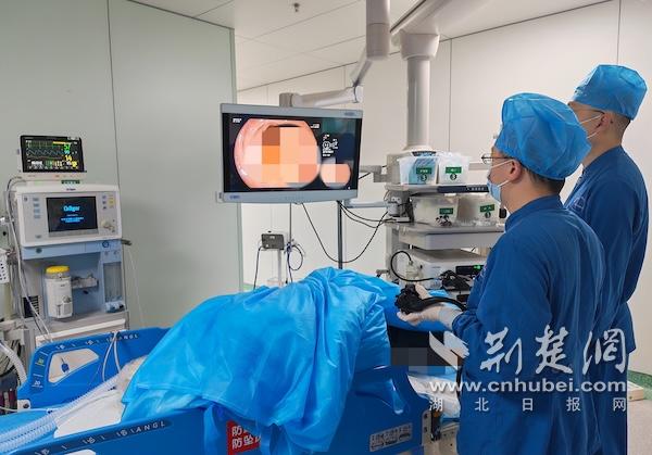  腹痛拖了两年，一查竟是“癌前病变”！医生：这个筛查能救命