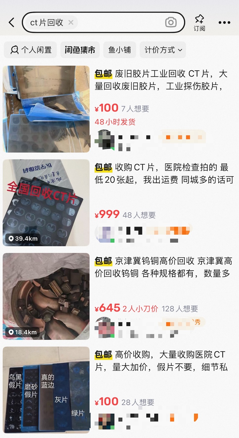 废旧CT片能高价回收？紧急提醒：别卖！
