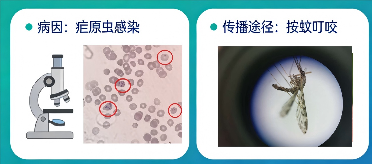 重症可导致肾衰竭、休克 这份疟疾防护指南请收好