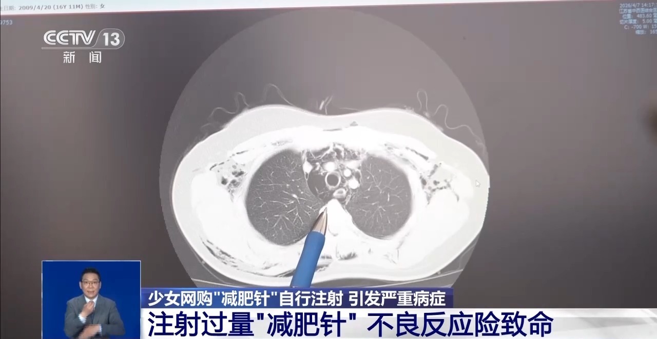 少女自行过量注射“减肥针”险致命 医生：使用需遵医嘱