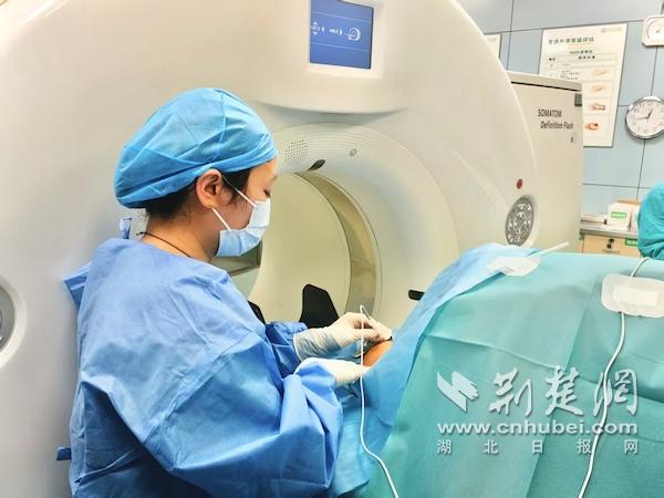 时隔二十年面神经再次“失控”  一根针精准化解面瘫困扰