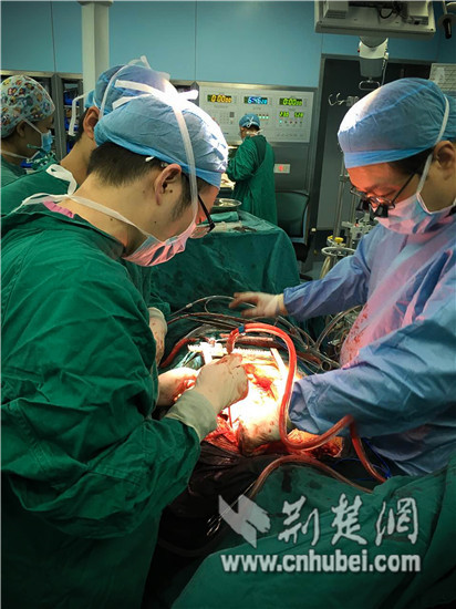[网络媒体走转改]同济外科医师方泽民：春节已完成五台手术