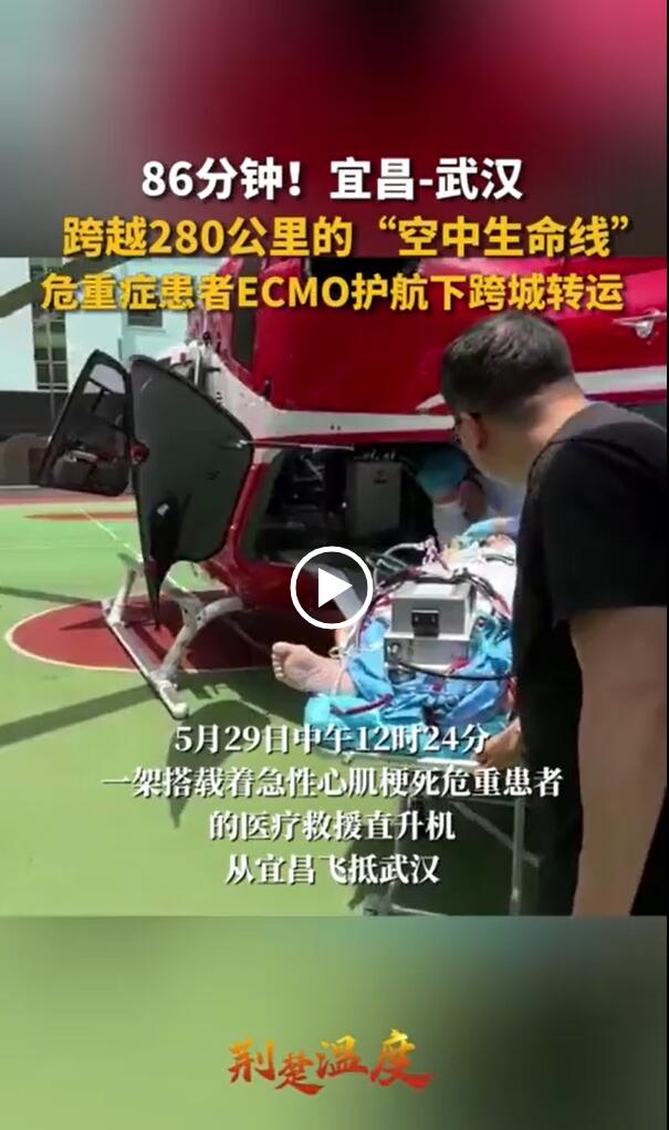 Խ280Σ֢ECMO¿ת