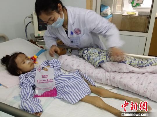 湖南6岁女童患罕见“贲门失弛缓症”体重仅8公斤