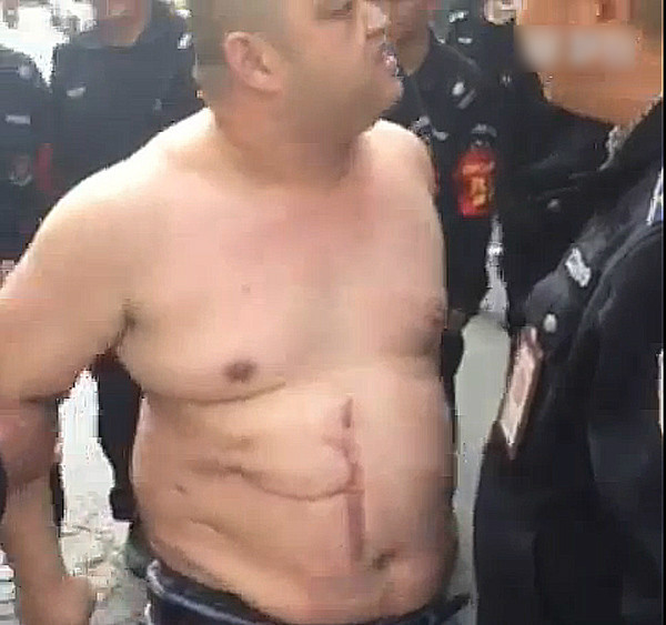 ֣�ݳಲ�̷��൶��ǹܶ��� �ǹܱ���̾������(ͼ)