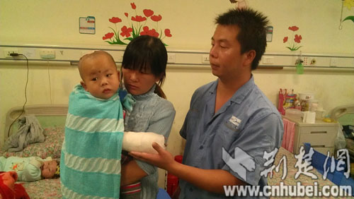 武汉第三医院两名贫困烫伤患儿获香港教授爱心