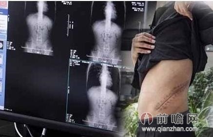 武汉卖肾车间被查获 图揭卖肾全过程