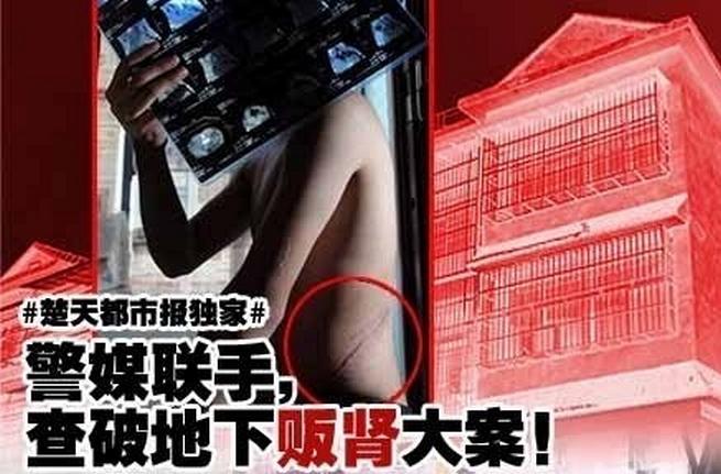 �人�������䱻��� ͼ������ȫ����