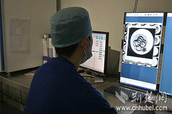 武汉试管婴儿动用监控视频 患者可筛选优秀