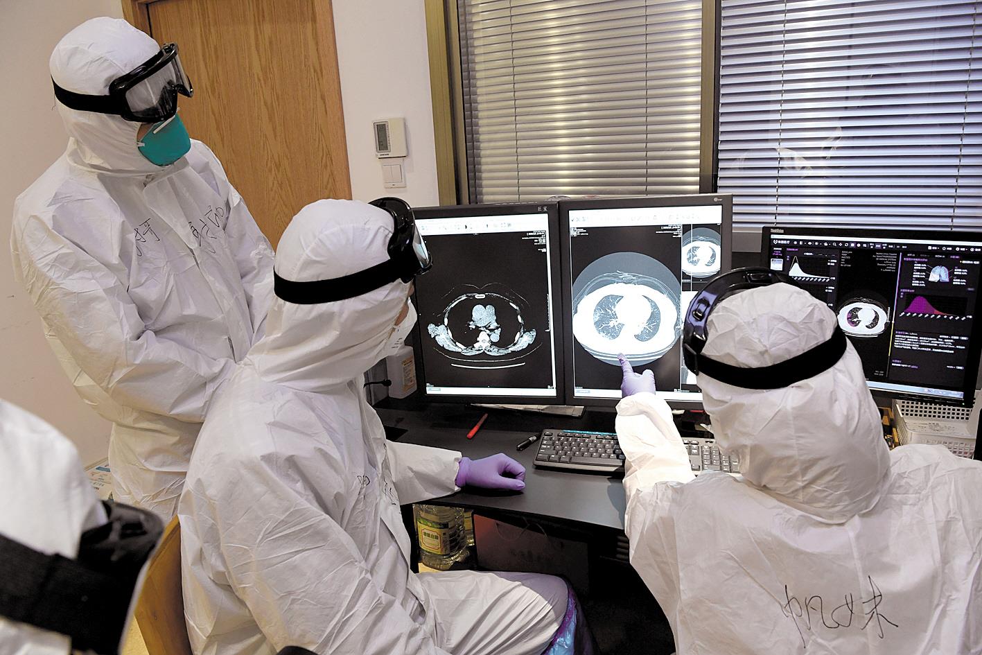 人工智能帮助医生分析肺部ct