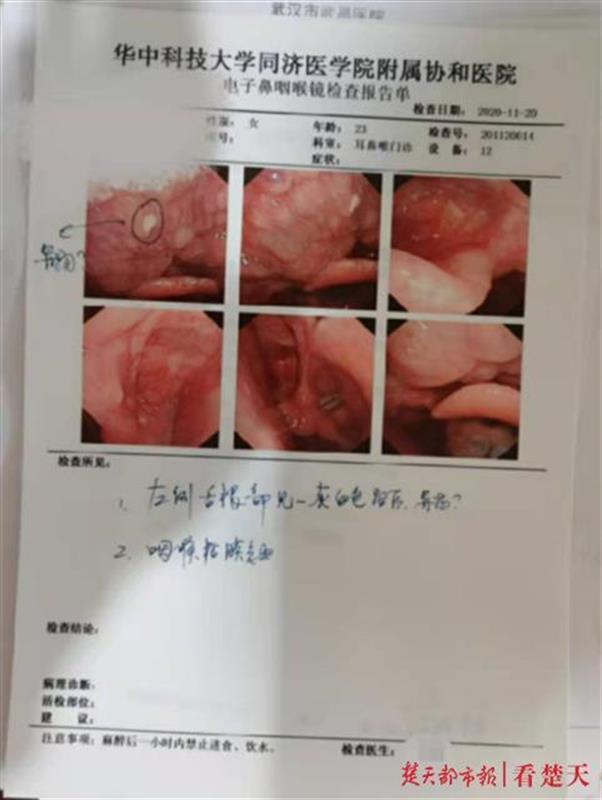 喉癌喉镜报告单图片图片