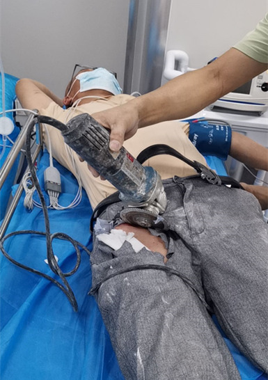 电锯"飞入"装修工大腿,医院开通0元入院通道展开救急