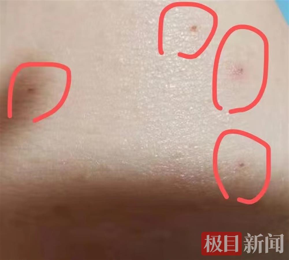 撸猫被抓伤责任谁来担律师店家应承担相应责任