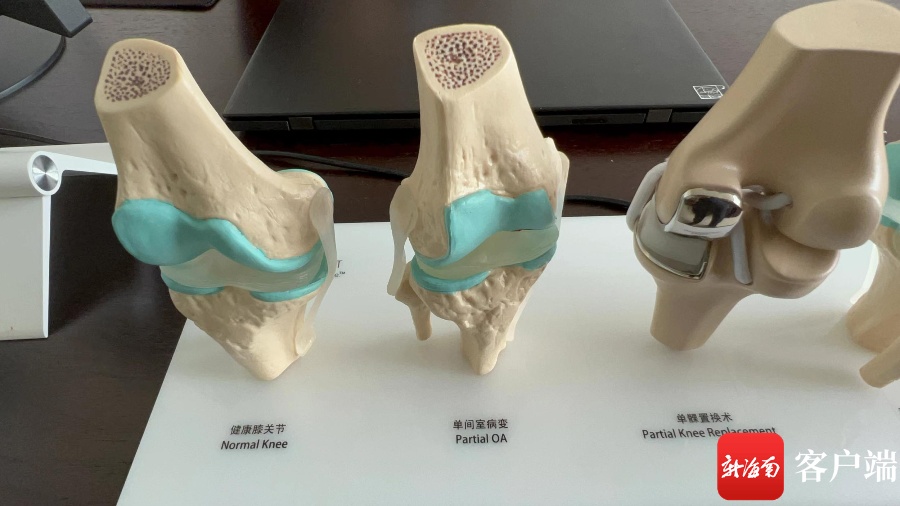新海南观察海南人工关节集采价落地一个月降价不降质付费少八成
